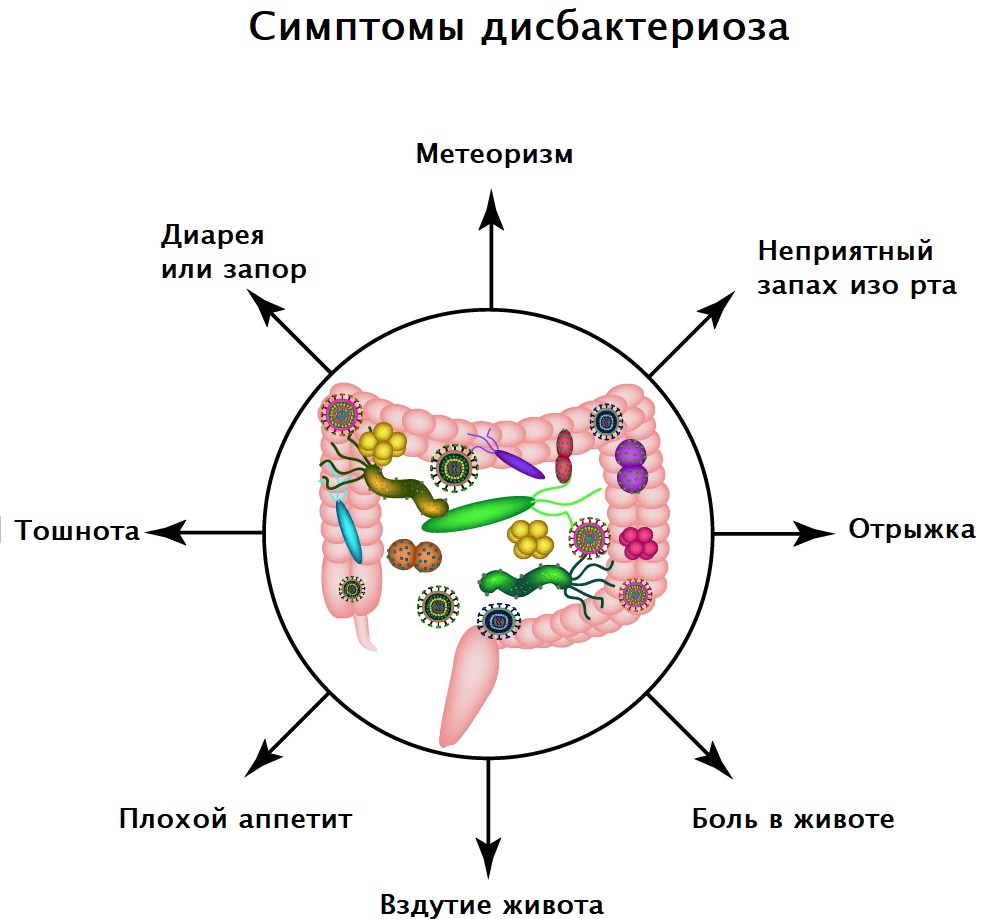 Что такое дисбактериоз кишечника